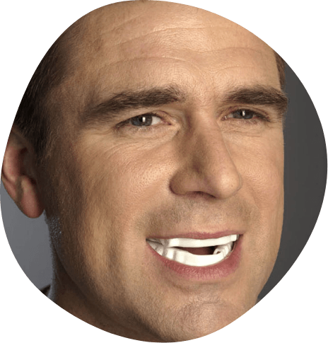 Man wearing white oral appliance over his teeth