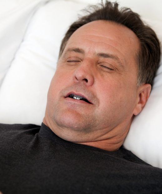 Sleeping man undergoing oral appliance therapy in Denton