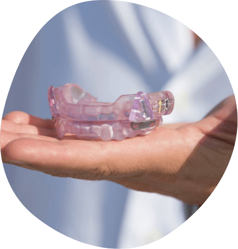 Person holding a light purple oral appliance in their hand